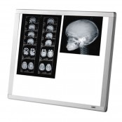 Yishun Négatoscope LED, 2...